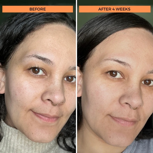 NWOB BeautyStat Universal C Skin Refiner All Skins Full Size 1 fl oz / 30 ml - Picture 11 of 13